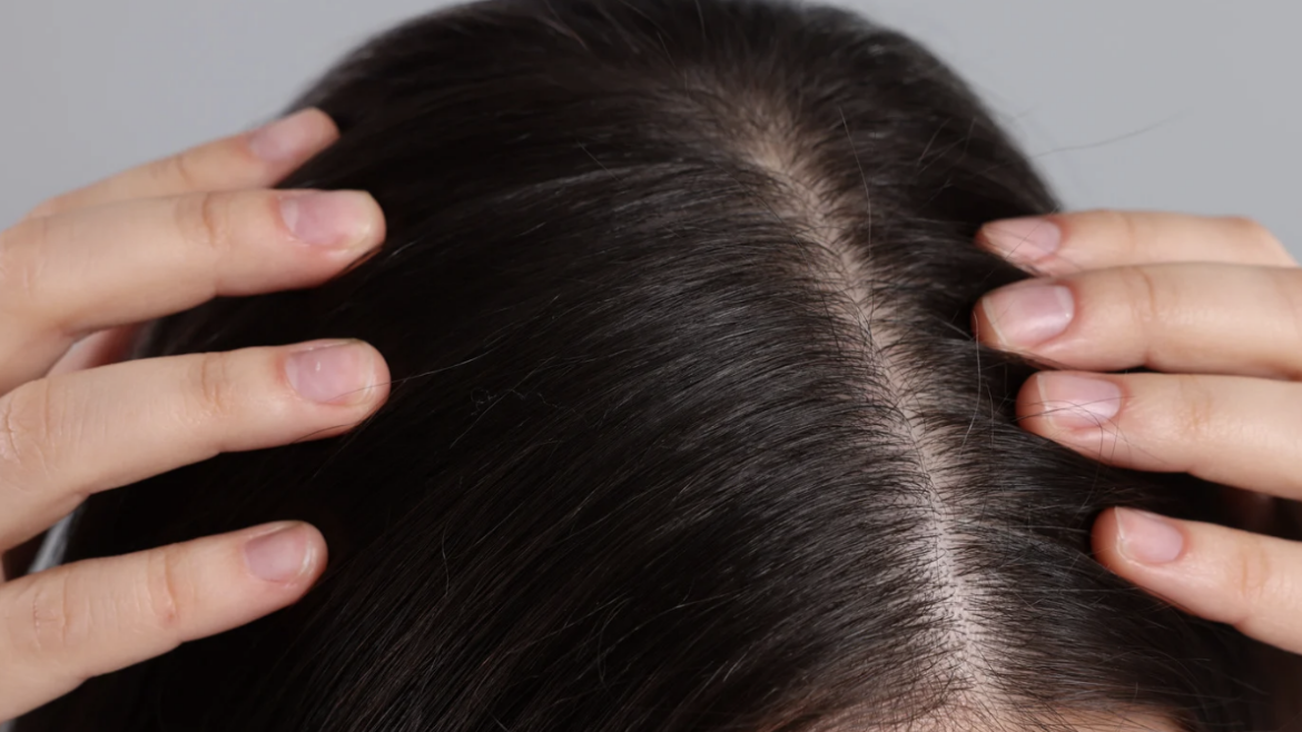 Trichologist in Silver Spring, Maryland for Scalp Health and Hair Regrowth